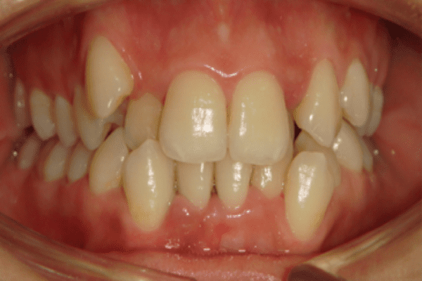 Before Image