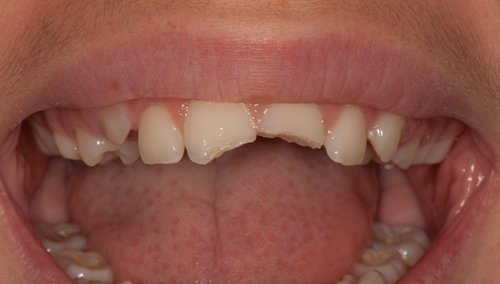 Before Image