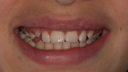 After Image