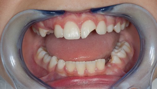 Before Image