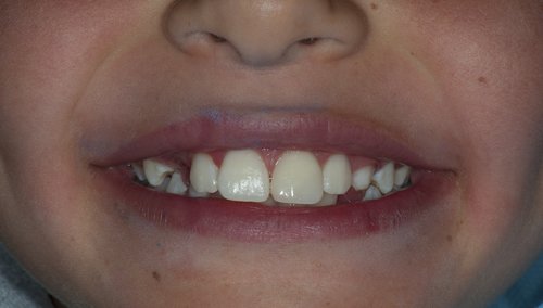 After Image