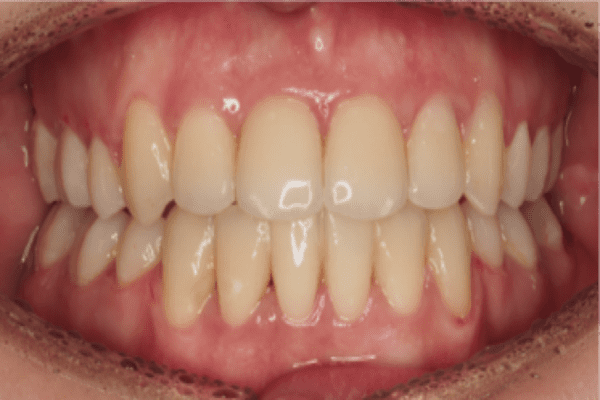 After Image