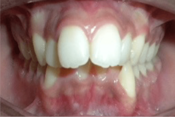 Before Image