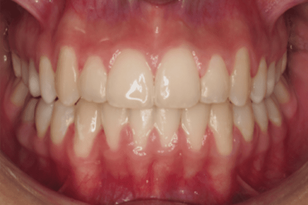 After Image