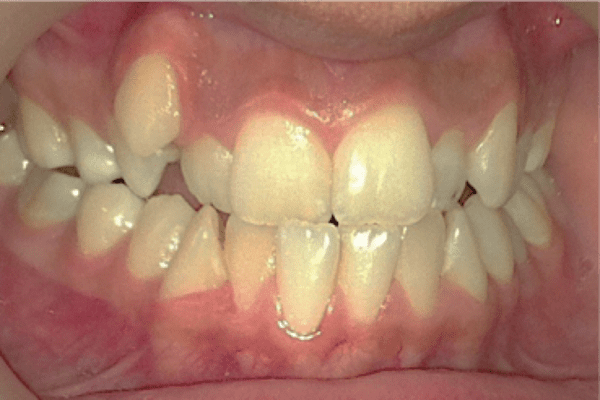 Before Image